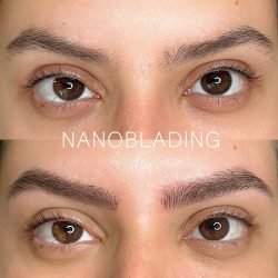 NANOBLADING